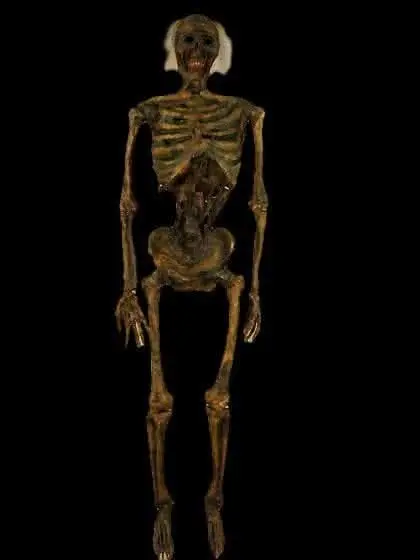 Life- Size Rotted Skeleton 1