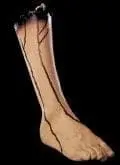 "Severed Right Leg" Bloody Body Part Halloween Prop 1